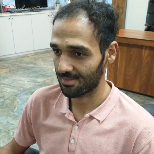 اصلاح کامل سر وصورت داماد، ماسک لایه بردار، بلک ماسک، آبرسان صورت