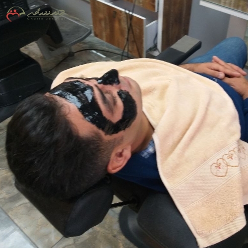 اصلاح کامل سر و صورت داماد، برداشت جوش ها، کراتینه موقت ،فیکساتور گریم صورت